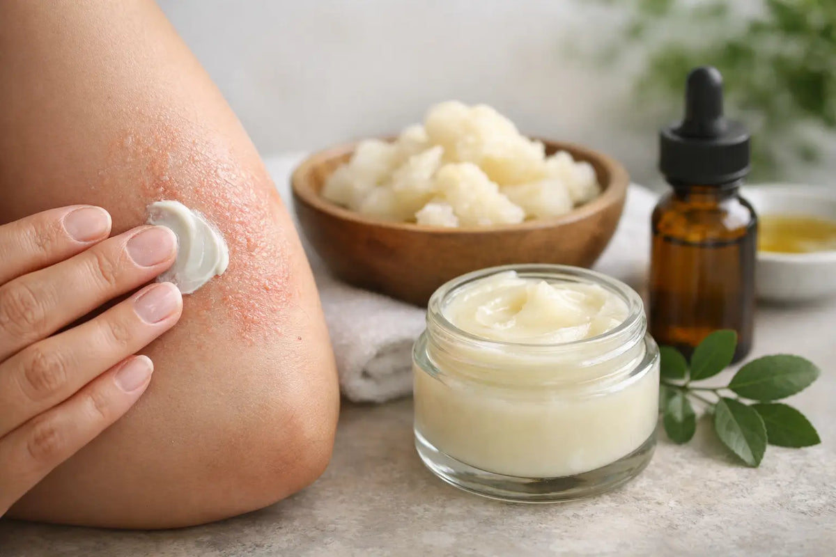 Tallow Eczema Results: What to Expect From Balm